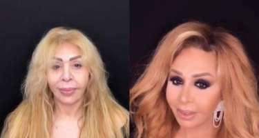 Mis.Az - Son Xeberler