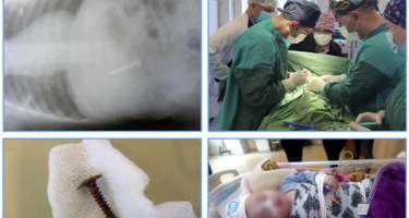 Mis.Az - Son Xeberler