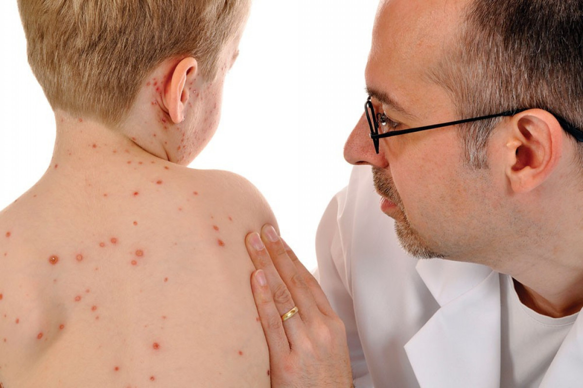 Mis.Az - Son Xeberler